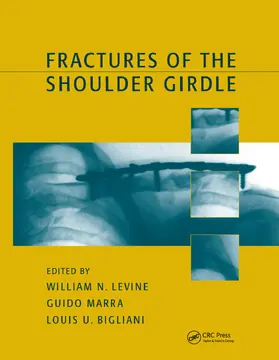 Levine / Marra |  Fractures of the Shoulder Girdle | Buch |  Sack Fachmedien