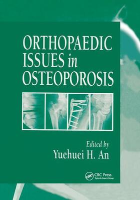 An |  Orthopaedic Issues in Osteoporosis | Buch |  Sack Fachmedien