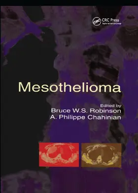 Robinson / Chahinian |  Mesothelioma | Buch |  Sack Fachmedien