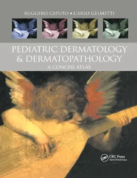 Gelmetti / Caputo |  Pediatric Dermatology and Dermatopathology | Buch |  Sack Fachmedien