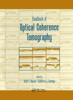 Bouma |  Handbook of Optical Coherence Tomography | Buch |  Sack Fachmedien