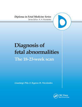 Pilu / Nicolaides |  Diagnosis of Fetal Abnormalities | Buch |  Sack Fachmedien