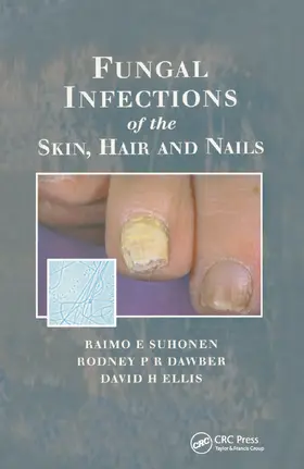 Suhonen / Dawber / Ellis |  Fungal Infections of the Skin and Nails | Buch |  Sack Fachmedien