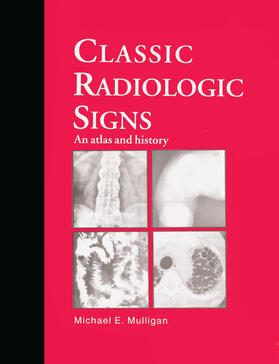 Mulligan |  Classic Radiologic Signs | Buch |  Sack Fachmedien