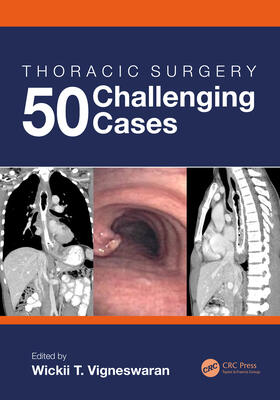 Vigneswaran |  Thoracic Surgery: 50 Challenging cases | Buch |  Sack Fachmedien