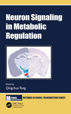Tong |  Neuron Signaling in Metabolic Regulation | Buch |  Sack Fachmedien