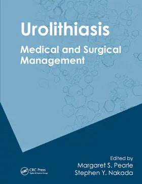 Pearle / Nakada |  Urolithiasis | Buch |  Sack Fachmedien