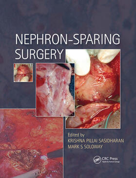 Sasidharan / Soloway |  Nephron-Sparing Surgery | Buch |  Sack Fachmedien