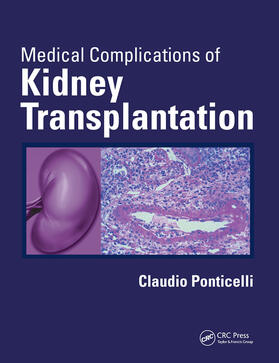 Ponticelli |  Medical Complications of Kidney Transplantation | Buch |  Sack Fachmedien