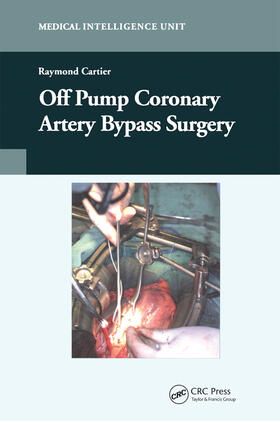 Cartier |  Off-Pump Coronary Artery Bypass Surgery | Buch |  Sack Fachmedien