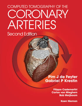 de Feyter / Krestin |  Computed Tomography of the Coronary Arteries | Buch |  Sack Fachmedien