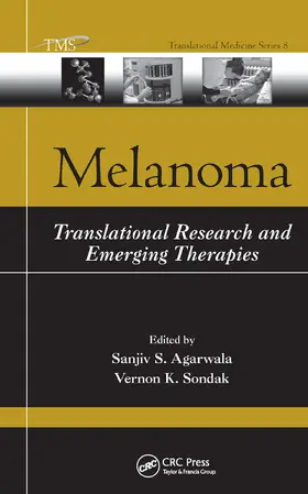 Agarwala / Sondak |  Melanoma | Buch |  Sack Fachmedien