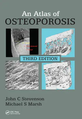 Stevenson / Marsh |  An Atlas of Osteoporosis | Buch |  Sack Fachmedien