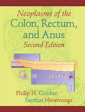 Gordon / Nivatvongs / Smith |  Neoplasms of the Colon, Rectum, and Anus | Buch |  Sack Fachmedien