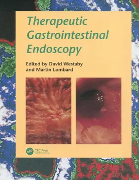 Westaby / Lombard |  Therapeutic Gastrointestinal Endoscopy | Buch |  Sack Fachmedien