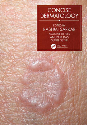 Sarkar |  Concise Dermatology | Buch |  Sack Fachmedien