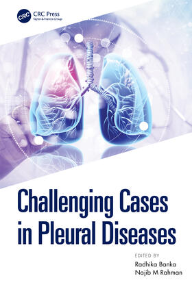 Rahman / Banka |  Challenging Cases in Pleural Diseases | Buch |  Sack Fachmedien