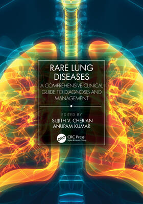 Kumar / Cherian |  Rare Lung Diseases | Buch |  Sack Fachmedien