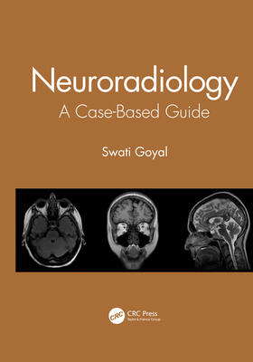 Goyal |  Neuroradiology | Buch |  Sack Fachmedien