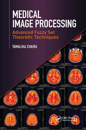 Chaira |  Medical Image Processing | Buch |  Sack Fachmedien