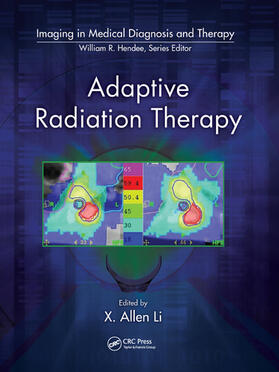 Li |  Adaptive Radiation Therapy | Buch |  Sack Fachmedien
