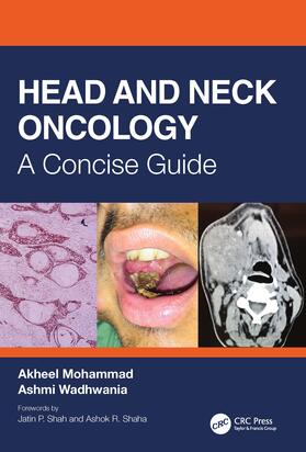 Mohammad / Wadhwania |  Head and Neck Oncology | Buch |  Sack Fachmedien