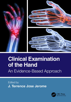 Jerome |  Clinical Examination of the Hand | Buch |  Sack Fachmedien