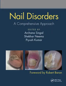 Singal / Kumar / Neema |  Nail Disorders | Buch |  Sack Fachmedien