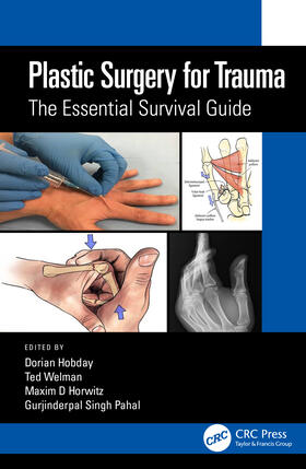 Hobday / Pahal / Welman |  Plastic Surgery for Trauma | Buch |  Sack Fachmedien