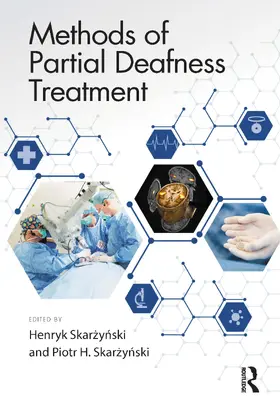 Skarzynski |  Methods of Partial Deafness Treatment | Buch |  Sack Fachmedien