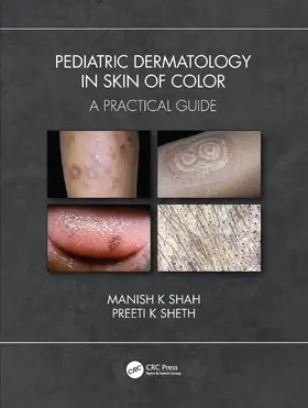 Shah / Sheth |  Pediatric Dermatology in Skin of Color | Buch |  Sack Fachmedien