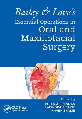 Shakib / Brennan / Singh |  Bailey & Love's Essential Operations in Oral & Maxillofacial Surgery | Buch |  Sack Fachmedien