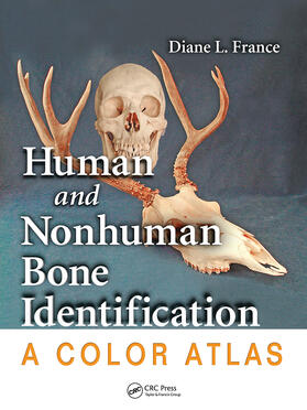 France |  Human and Nonhuman Bone Identification | Buch |  Sack Fachmedien