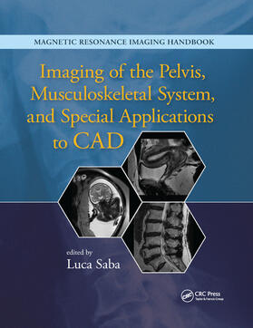 Saba |  Imaging of the Pelvis, Musculoskeletal System, and Special Applications to CAD | Buch |  Sack Fachmedien