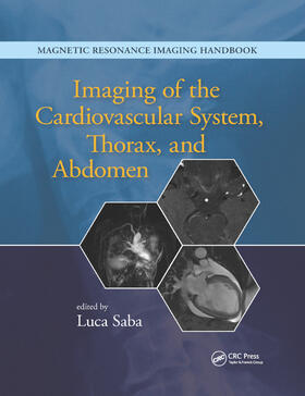 Saba |  Imaging of the Cardiovascular System, Thorax, and Abdomen | Buch |  Sack Fachmedien