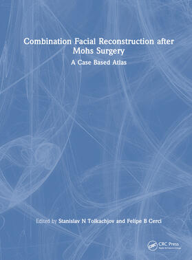 Cerci / Tolkachjov |  Combination Facial Reconstruction after Mohs Surgery | Buch |  Sack Fachmedien