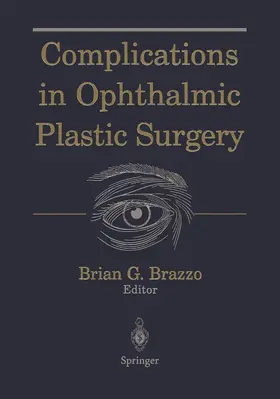 Brazzo |  Complications in Ophthalmic Plastic Surgery | Buch |  Sack Fachmedien