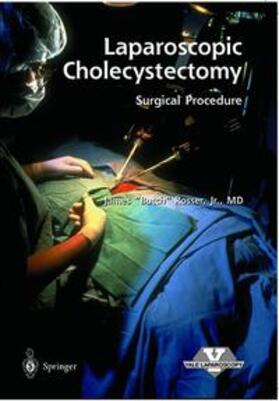 Rosser |  Laparoscopic Cholecystectomy - Surgical Procedure | Sonstiges |  Sack Fachmedien