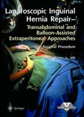 Rosser |  Laparoscopic Inguinal Hernia Repair - Surgical Procedure | Sonstiges |  Sack Fachmedien
