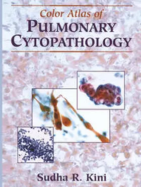 Kini |  Color Atlas of Pulmonary Cytopathology | eBook | Sack Fachmedien