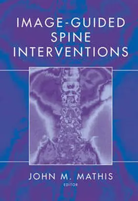 Mathis |  Image-Guided Spine Interventions | eBook | Sack Fachmedien