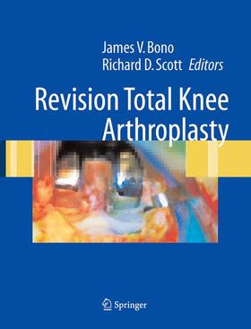Bono / Scott |  Revision Total Knee Arthroplasty | Buch |  Sack Fachmedien