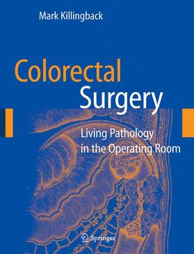 Killingback |  Colorectal Surgery | Buch |  Sack Fachmedien