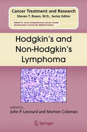 Coleman / Leonard |  Hodgkin's and Non-Hodgkin's Lymphoma | Buch |  Sack Fachmedien