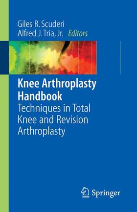 Scuderi / Tria | Knee Arthroplasty Handbook | Buch | 978-0-387-30730-5 | sack.de