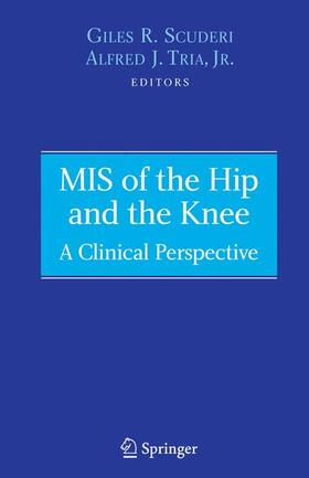 Scuderi / Tria |  MIS of the Hip and the Knee | Buch |  Sack Fachmedien