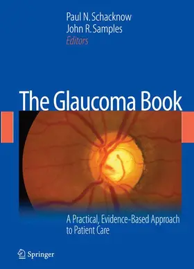 Schacknow / Samples |  The Glaucoma Book | Buch |  Sack Fachmedien