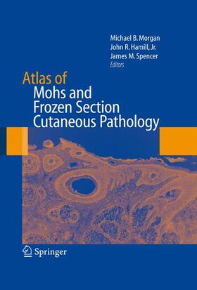 Morgan / Hamill / Spencer |  Atlas of Mohs and Frozen Section Cutaneous Pathology | Buch |  Sack Fachmedien