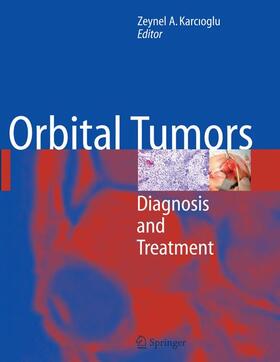 Karcioglu |  Orbital Tumors | Buch |  Sack Fachmedien