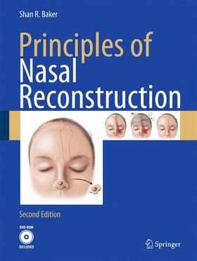 Baker |  Principles of Nasal Reconstruction | Buch |  Sack Fachmedien